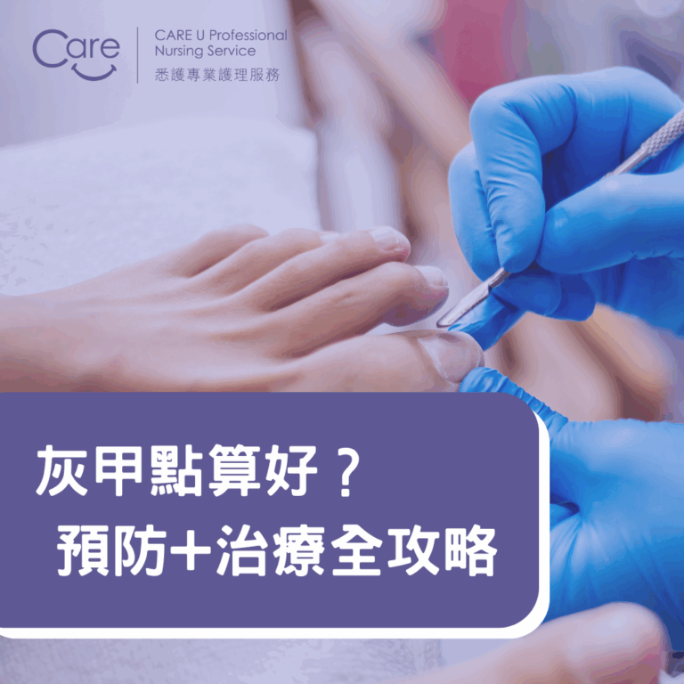 Read more about the article 【護理小知識】灰甲點算好？預防+治療全攻略